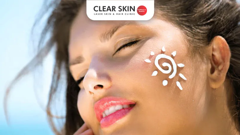 Sun Tan Removal How to get rid of hyperpigmentation due to sun exposure