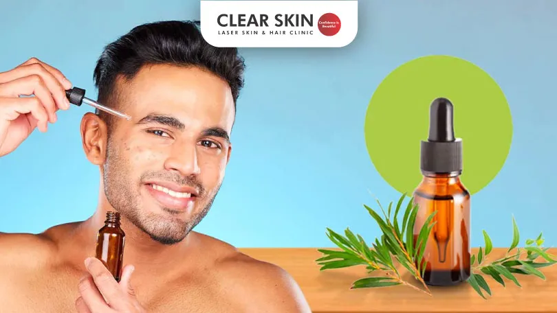 Tea Tree Oil for Acne Scars Is it Effective Clear Skin Pune