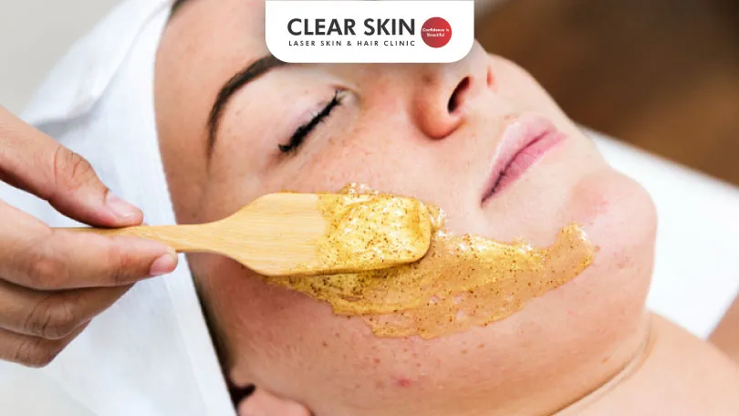 Ayurvedic Treatment for Melasma: Natural Remedies for Clear Skin