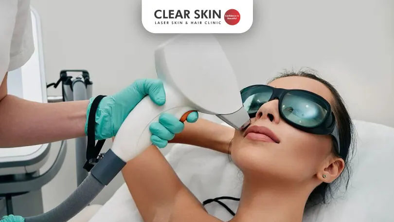 The-Ultimate-Laser-Hair-Removal-Guide-Where-to-Go-for-Best-LHR-clear-skin-pune