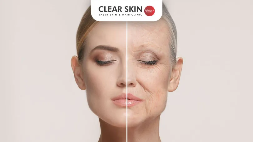 The Effects of Aging on Your Skin: What to Expect