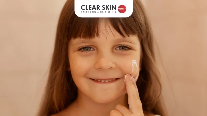 What Causes Melasma in Children?