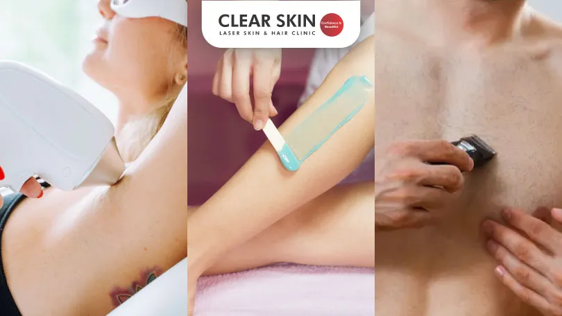 Safest Methods for Unwanted Hair Removal