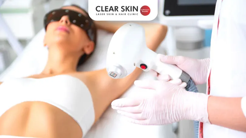 What to do When Laser Hair Removal Doesn’t Work?