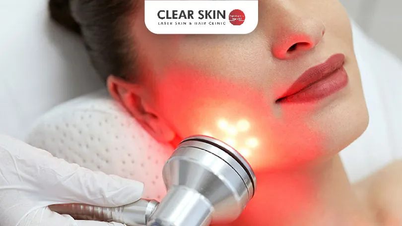 Why Laser Treatment is Good for Your Skin Benefits Care Tips