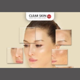 The Effects of Aging on Your Skin