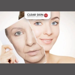 Guide to Anti-Aging Skin Treatments