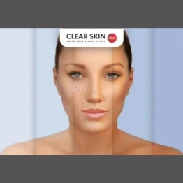 Difference Between Tanning and Pigmentation