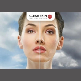 Anti-Pollution Skin Care Guide