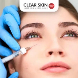 PRP Therapy for Dark Circles