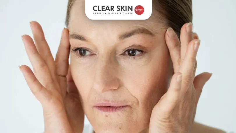 The Effects of Aging on Your Skin: What to Expect